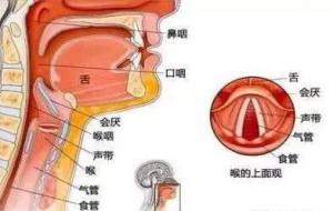 听障人是什么意思